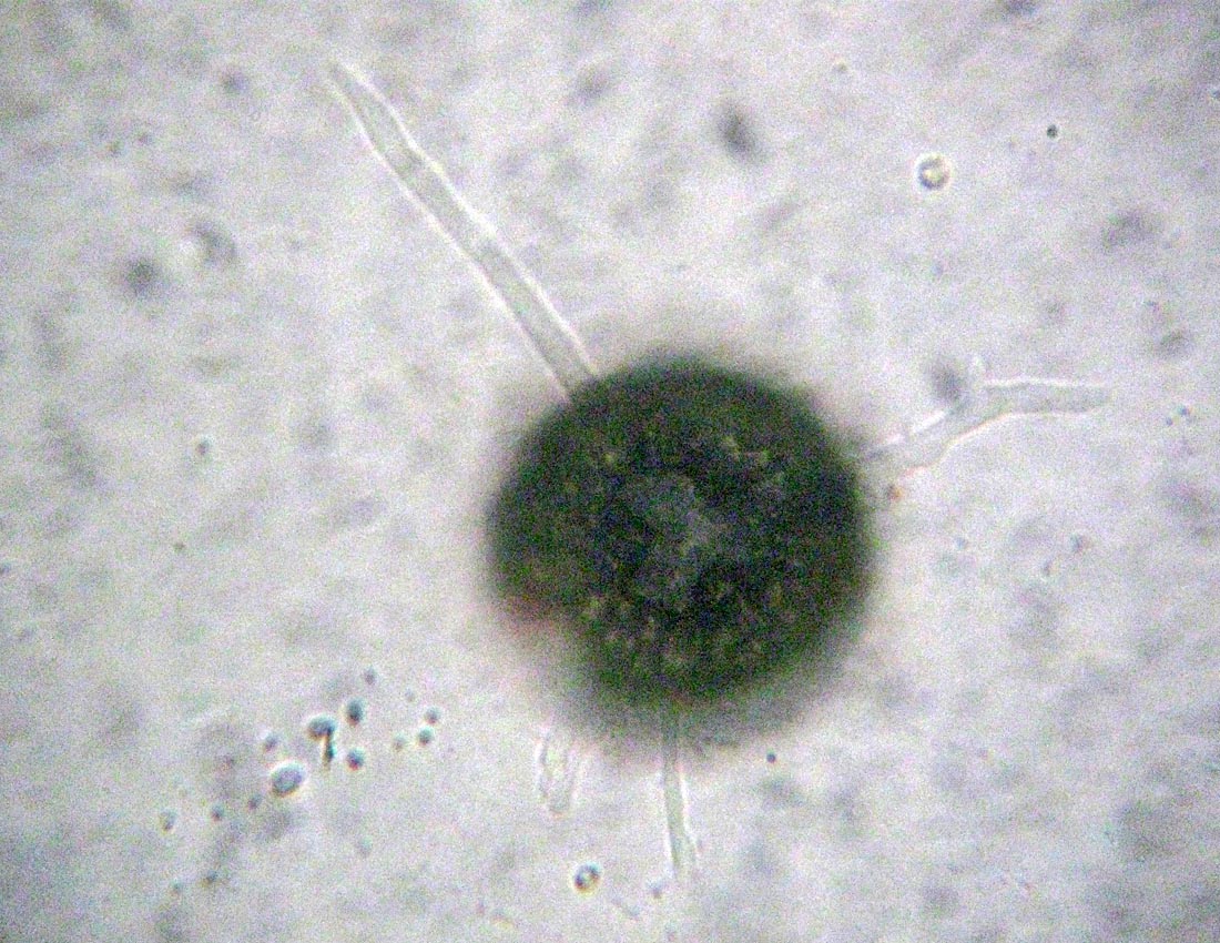 Difflugia verosimilmente gramen